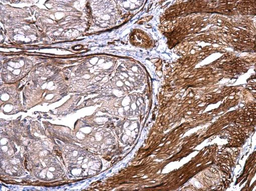 Immunohistochemistry (Formalin/PFA-fixed paraffin-embedded sections) - Anti-CD146 antibody - C-terminal (AB228540)