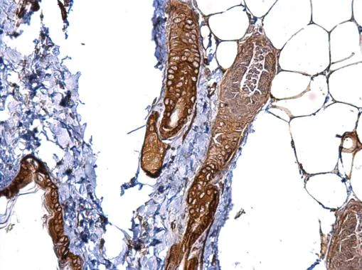 Immunohistochemistry (Formalin/PFA-fixed paraffin-embedded sections) - Anti-CD146 antibody - C-terminal (AB228540)