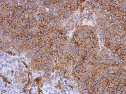 Immunohistochemistry (Formalin/PFA-fixed paraffin-embedded sections) - Anti-CD146 antibody - C-terminal (AB228540)