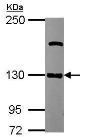 Western blot - Anti-CD146 antibody - C-terminal (AB228540)
