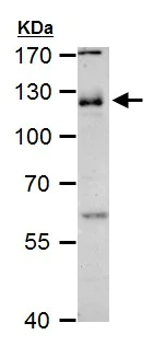 Western blot - Anti-CD146 antibody - C-terminal (AB228540)