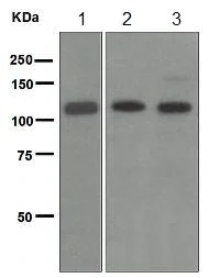 Western blot - Anti-CD146 antibody [EPR3207(2)] (AB134065)