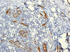 Immunohistochemistry (Formalin/PFA-fixed paraffin-embedded sections) - Anti-CD146 antibody [EPR3208] (AB75769)