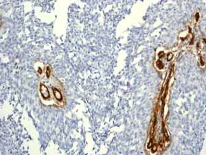 Immunohistochemistry (Formalin/PFA-fixed paraffin-embedded sections) - Anti-CD146 antibody [EPR3208] (AB75769)