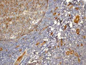 Immunohistochemistry (Formalin/PFA-fixed paraffin-embedded sections) - Anti-CD146 antibody [EPR3208] (AB75769)