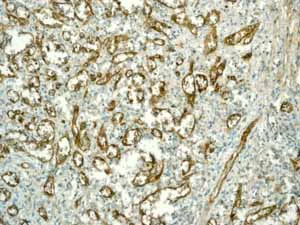 Immunohistochemistry (Formalin/PFA-fixed paraffin-embedded sections) - Anti-CD146 antibody [EPR3208] (AB75769)