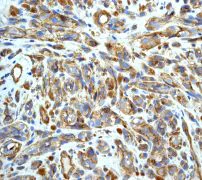 Immunohistochemistry (Formalin/PFA-fixed paraffin-embedded sections) - Anti-CD146 antibody [EPR3208] (AB75769)