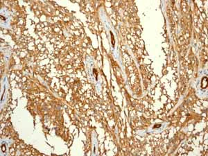 Immunohistochemistry (Formalin/PFA-fixed paraffin-embedded sections) - Anti-CD146 antibody [EPR3208] - BSA and Azide free (AB210072)