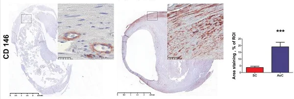 Immunohistochemistry (Formalin/PFA-fixed paraffin-embedded sections) - Anti-CD146 antibody [EPR3208] - BSA and Azide free (AB210072)