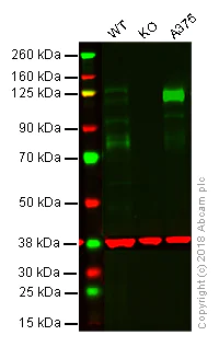 Western blot - Anti-CD146 antibody [EPR3208] - BSA and Azide free (AB210072)