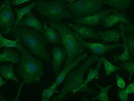 Immunocytochemistry/ Immunofluorescence - Anti-CD147 antibody [10E10] (ab230921), expandable thumbnail