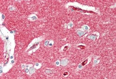 Immunohistochemistry (Formalin/PFA-fixed paraffin-embedded sections) - Anti-CD147 antibody [10E10] (AB230921), expandable thumbnail
