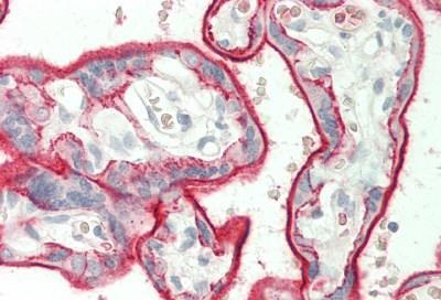 Immunohistochemistry (Formalin/PFA-fixed paraffin-embedded sections) - Anti-CD147 antibody [10E10] (AB230921), expandable thumbnail