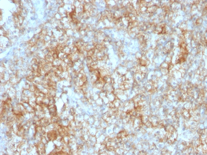 Immunohistochemistry (Formalin/PFA-fixed paraffin-embedded sections) - Anti-CD147 antibody [8D6] - BSA and Azide free (AB212854), expandable thumbnail