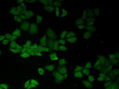 Immunocytochemistry/ Immunofluorescence - Anti-CD147 antibody (AB232967), expandable thumbnail