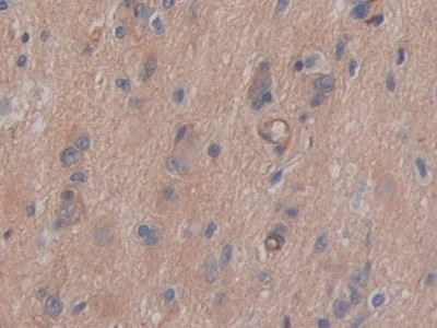Immunohistochemistry (Formalin/PFA-fixed paraffin-embedded sections) - Anti-CD147 antibody (ab232967), expandable thumbnail