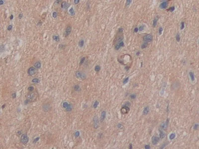Immunohistochemistry (Formalin/PFA-fixed paraffin-embedded sections) - Anti-CD147 antibody (AB232967)