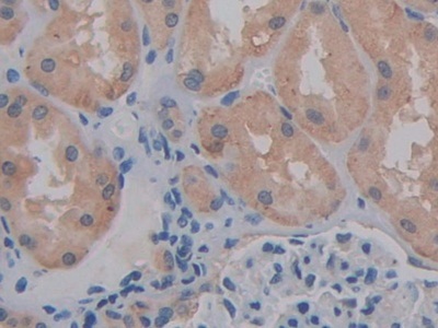 Immunohistochemistry (Formalin/PFA-fixed paraffin-embedded sections) - Anti-CD147 antibody (ab232967), expandable thumbnail