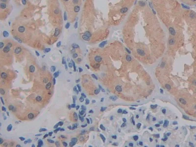 Immunohistochemistry (Formalin/PFA-fixed paraffin-embedded sections) - Anti-CD147 antibody (AB232967)