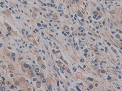 Immunohistochemistry (Formalin/PFA-fixed paraffin-embedded sections) - Anti-CD147 antibody (ab232967), expandable thumbnail