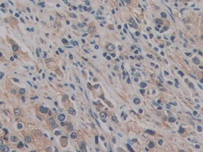 Immunohistochemistry (Formalin/PFA-fixed paraffin-embedded sections) - Anti-CD147 antibody (AB232967)