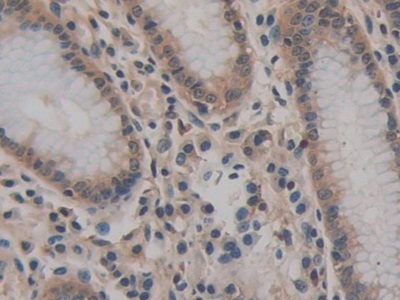 Immunohistochemistry (Formalin/PFA-fixed paraffin-embedded sections) - Anti-CD147 antibody (ab232967), expandable thumbnail