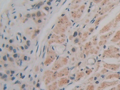 Immunohistochemistry (Formalin/PFA-fixed paraffin-embedded sections) - Anti-CD147 antibody (AB232967), expandable thumbnail