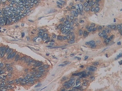 Immunohistochemistry (Formalin/PFA-fixed paraffin-embedded sections) - Anti-CD147 antibody (AB232967), expandable thumbnail