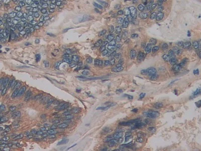 Immunohistochemistry (Formalin/PFA-fixed paraffin-embedded sections) - Anti-CD147 antibody (AB232967)