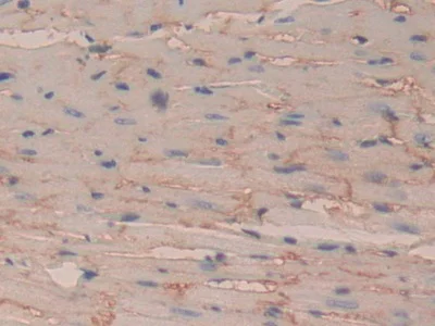 Immunohistochemistry (Formalin/PFA-fixed paraffin-embedded sections) - Anti-CD147 antibody (AB232991)