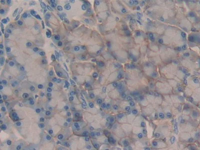 Immunohistochemistry (Formalin/PFA-fixed paraffin-embedded sections) - Anti-CD147 antibody (AB232991)