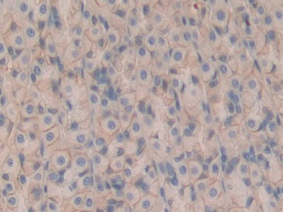 Immunohistochemistry (Formalin/PFA-fixed paraffin-embedded sections) - Anti-CD147 antibody (AB232991)
