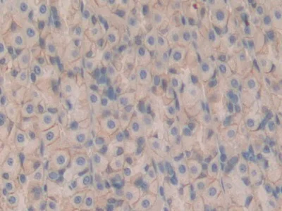 Immunohistochemistry (Formalin/PFA-fixed paraffin-embedded sections) - Anti-CD147 antibody (AB232991)