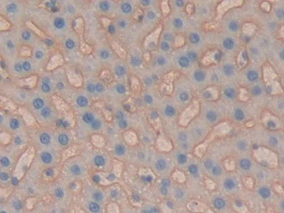 Immunohistochemistry (Formalin/PFA-fixed paraffin-embedded sections) - Anti-CD147 antibody (AB232991)