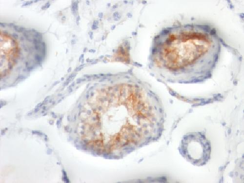 Immunohistochemistry (Formalin/PFA-fixed paraffin-embedded sections) - Anti-CD147 antibody [BSG/963] - BSA and Azide free (AB212856), expandable thumbnail