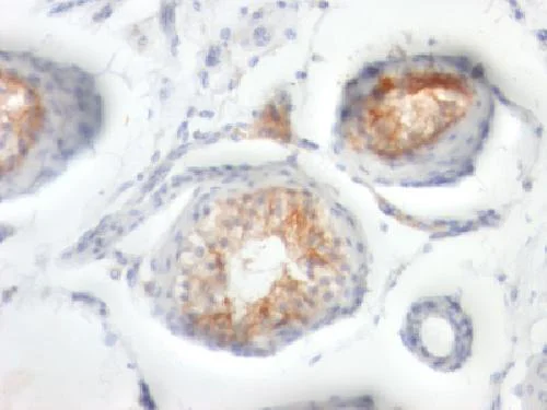 Immunohistochemistry (Formalin/PFA-fixed paraffin-embedded sections) - Anti-CD147 antibody [BSG/963] - BSA and Azide free (AB212856)