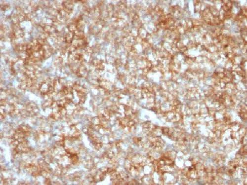 Immunohistochemistry (Formalin/PFA-fixed paraffin-embedded sections) - Anti-CD147 antibody [BSG/963] - BSA and Azide free (AB212856), expandable thumbnail