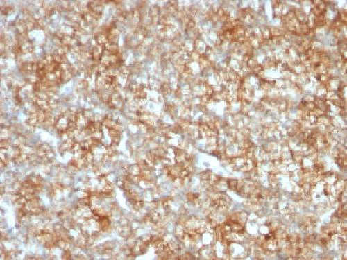 Immunohistochemistry (Formalin/PFA-fixed paraffin-embedded sections) - Anti-CD147 antibody [BSG/963] - BSA and Azide free (AB212856)