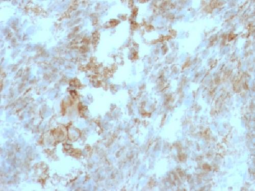 Immunohistochemistry (Formalin/PFA-fixed paraffin-embedded sections) - Anti-CD147 antibody [BSG/963] - BSA and Azide free (AB212856), expandable thumbnail