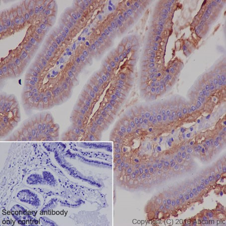 Immunohistochemistry (Formalin/PFA-fixed paraffin-embedded sections) - Anti-CD147 antibody [EPR18008-67] (AB212057), expandable thumbnail