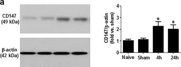 Western blot - Anti-CD147 antibody [EPR18008-8] (AB188190)