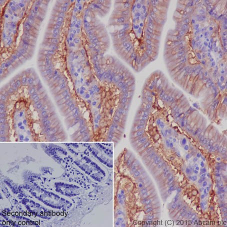 Immunohistochemistry (Formalin/PFA-fixed paraffin-embedded sections) - Anti-CD147 antibody [EPR18008-8] - BSA and Azide free (AB222389), expandable thumbnail