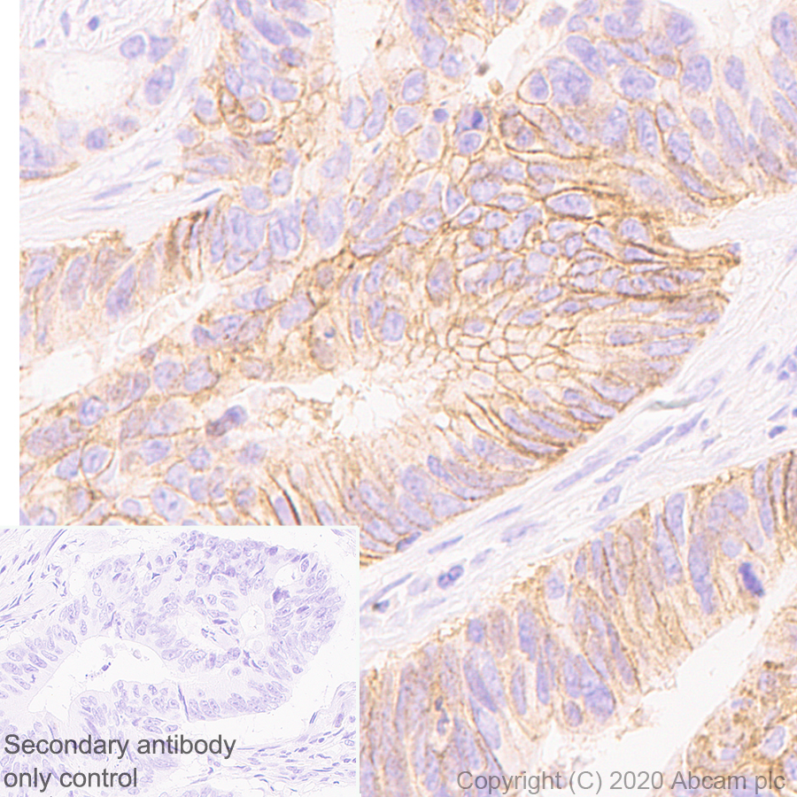 Immunohistochemistry (Formalin/PFA-fixed paraffin-embedded sections) - Anti-CD147 antibody [EPR4053] (AB108308), expandable thumbnail
