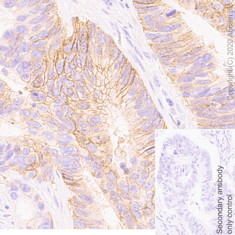 Immunohistochemistry (Formalin/PFA-fixed paraffin-embedded sections) - Anti-CD147 antibody [EPR4053] (AB108308)