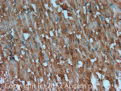 Immunohistochemistry (Formalin/PFA-fixed paraffin-embedded sections) - Anti-CD147 antibody [MEM-M6/1] (AB666)