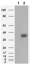 Western blot - Anti-CD147 antibody [OTI9B10] (AB119020), expandable thumbnail