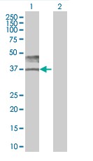 Western blot - CD147 overexpression 293T lysate (whole cell) (AB94097)