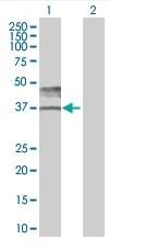 Western blot - CD147 overexpression 293T lysate (whole cell) (AB94097)