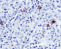 Immunohistochemistry (Formalin/PFA-fixed paraffin-embedded sections) - Anti-CD15 antibody [EPR9521] (AB172729)