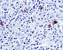Immunohistochemistry (Formalin/PFA-fixed paraffin-embedded sections) - Anti-CD15 antibody [EPR9521] - BSA and Azide free (AB240171), expandable thumbnail
